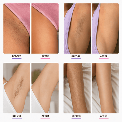 Veluneo™ 2-in-1 Body Shaver